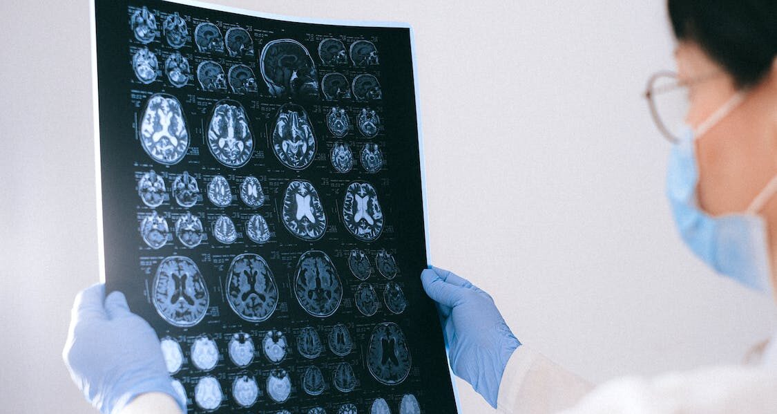 SPECT Scans: Ontario Courts’ Grapple with a “Novel” Evidentiary Tool - photo